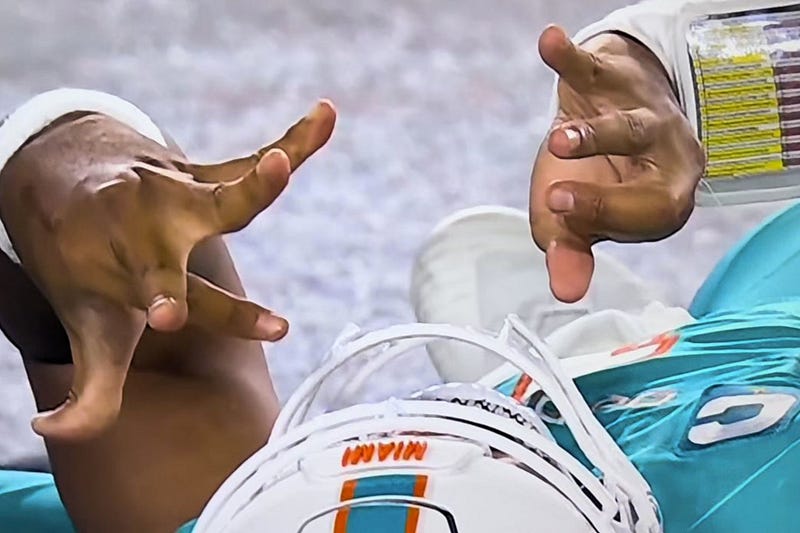 Opinion: the NFL will continue to skate by